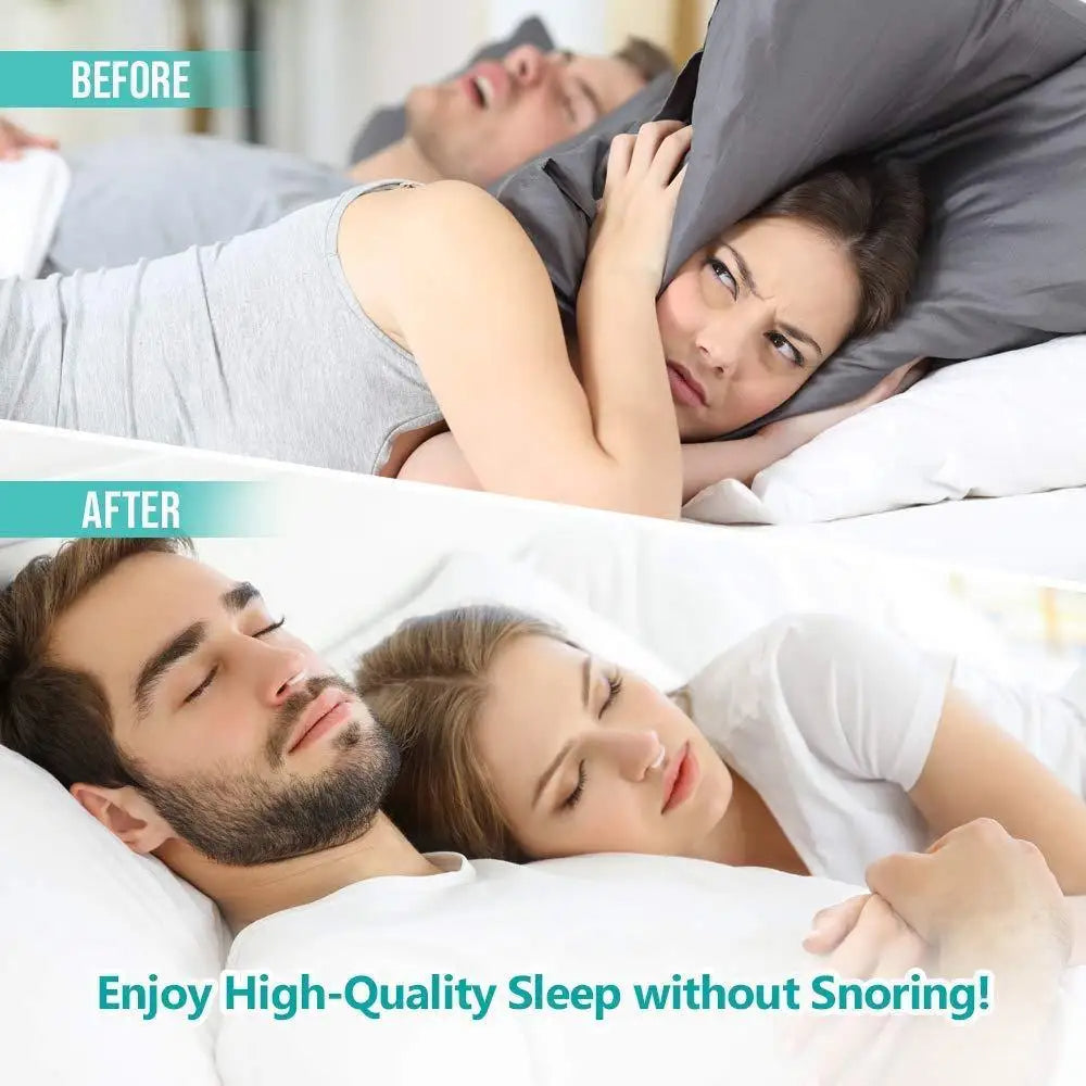 Portable Anti Snoring Nose Clip for Men and Women (Buy 1 get 1 Free)