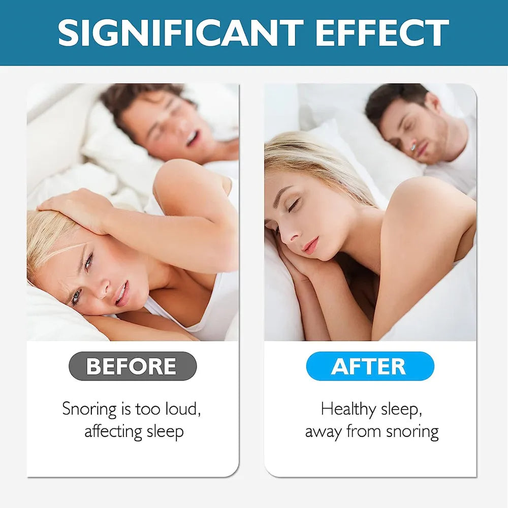 Portable Anti Snoring Nose Clip for Men and Women (Buy 1 get 1 Free)